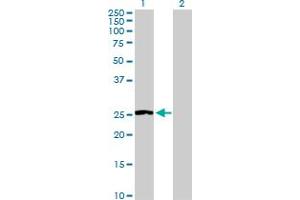 Western Blot analysis of NNMT expression in transfected 293T cell line by NNMT MaxPab polyclonal antibody. (NNMT anticorps  (AA 1-264))