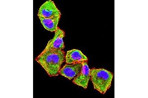Immunofluorescence analysis of Hela cells using CD182 mouse mAb (green).