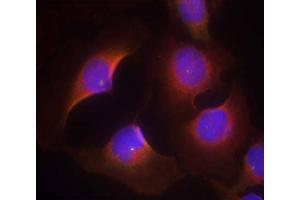 Immunofluorescence staining of methanol-fixed HeLa cells using CDK6 (phospho-Tyr13) Antibody (E011542, Red) (CDK6 anticorps  (pTyr13))