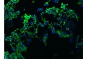 anti-Keratin 10/13 antibody