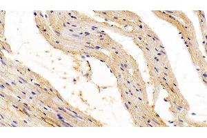 Detection of TGFb1 in Rat Cardiac Muscle Tissue using Polyclonal Antibody to Transforming Growth Factor Beta 1 (TGFb1) (TGFB1 anticorps  (AA 279-390))