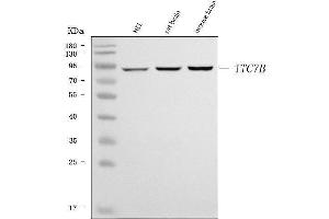 Western blot analysis of TTC7B using anti-TTC7B antibody (ABIN7601050). (TTC7B anticorps  (AA 275-730))