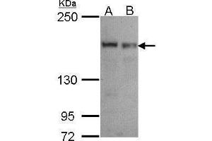 WB Image Sample (30 ug of whole cell lysate) A: A549 B: Hela 5% SDS PAGE antibody diluted at 1:1000 (SEC31A anticorps  (N-Term))
