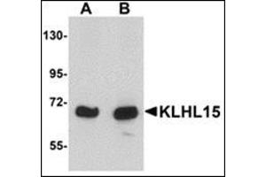 Western blot analysis of KLHL15 in HeLa cell lysate with this product at (A) 1 and (B) 2 μg/ml. (KLHL15 anticorps  (C-Term))