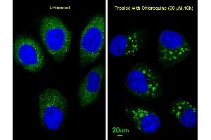 Immunofluorescent analysis of  cells, using LC3 Antibody (G8B) (N-term) 1802a. (MAP1LC3A anticorps  (N-Term))