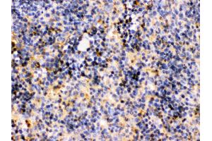 TRIB2 was detected in paraffin-embedded sections of mouse spleen tissues using rabbit anti- TRIB2 Antigen Affinity purified polyclonal antibody at 1 μg/mL.