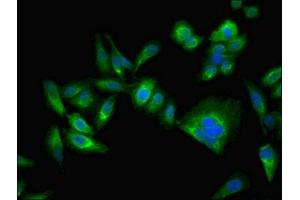 Immunofluorescent analysis of Hela cells using ABIN7146715 at dilution of 1:100 and Alexa Fluor 488-congugated AffiniPure Goat Anti-Rabbit IgG(H+L) (CA2 anticorps  (AA 2-260))
