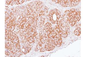 IHC-P Image Immunohistochemical analysis of paraffin-embedded SW480 xenograft, using ret finger protein, antibody at 1:100 dilution. (TRIM27 anticorps)