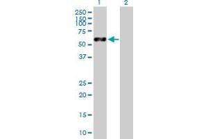 Western Blot analysis of VIM expression in transfected 293T cell line by VIM MaxPab polyclonal antibody. (Vimentin anticorps  (AA 1-466))