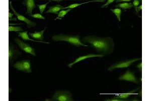 Immunofluorescence of purified MaxPab antibody to BOLL on HeLa cell. (BOLL anticorps  (AA 1-295))
