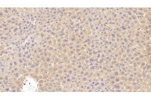 Detection of CDKN2B in Mouse Liver Tissue using Polyclonal Antibody to Cyclin Dependent Kinase Inhibitor 2B (CDKN2B) (CDKN2B anticorps  (AA 1-130))
