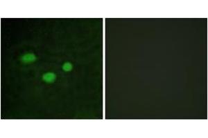 Immunofluorescence analysis of HeLa cells, using DNMT3B Antibody.