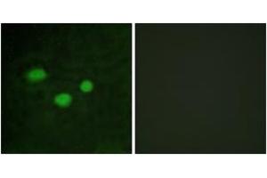 Immunofluorescence analysis of HeLa cells, using DNMT3B Antibody. (DNMT3B anticorps  (AA 1-50))