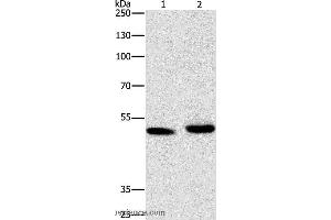 Western blot analysis of 231 cell and human liver cancer tissue, using ATG4A Polyclonal Antibody at dilution of 1:300 (ATG4A anticorps)
