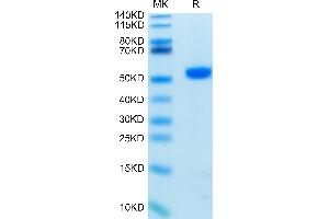 Biotinylated Human CD4 on Tris-Bis PAGE under reduced condition. (CD4 Protein (CD4) (His-Avi Tag,Biotin))