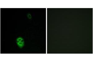 Immunofluorescence analysis of A549 cells, using OR4K17 Antibody.