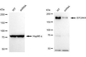 Western blotting analysis using EIF2AK4 antibody (ABIN7798505).