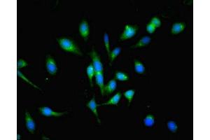 Immunofluorescent analysis of Hela cells using ABIN7163729 at dilution of 1:100 and Alexa Fluor 488-congugated AffiniPure Goat Anti-Rabbit IgG(H+L) (POGK anticorps  (AA 101-400))