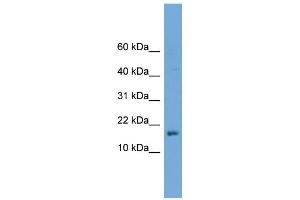 WB Suggested Anti-C14orf129 Antibody Titration: 0. (GSKIP anticorps  (Middle Region))