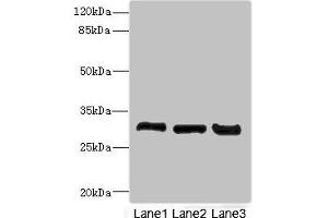 Western blot All lanes: KHKantibody at 3.