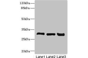 Western blot All lanes: KHKantibody at 3. (Ketohexokinase anticorps  (AA 1-298))