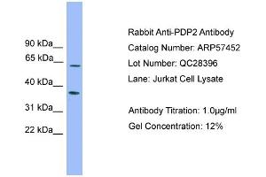 WB Suggested Anti-PDP2  Antibody Titration: 0. (PDP2 anticorps  (Middle Region))