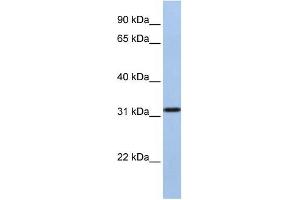 SLC25A28 antibody used at 1 ug/ml to detect target protein. (SLC25A28 anticorps  (C-Term))