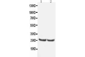 Anti-TIMP4 antibody, Western blotting All lanes: Anti TIMP4  at 0. (TIMP4 anticorps  (C-Term))