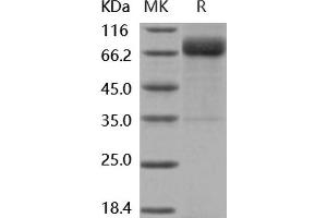 Western Blotting (WB) image for Growth Hormone Receptor (GHR) (Active) protein (His tag,Fc Tag) (ABIN7320419)