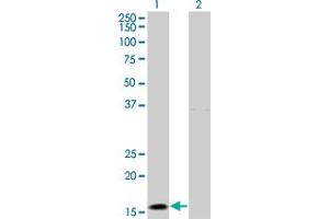 Western Blot analysis of IFNA2 expression in transfected 293T cell line by IFNA2 monoclonal antibody (M28), clone 1B4. (IFNA2 anticorps  (AA 24-188))
