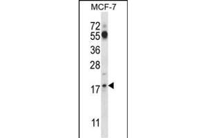 SSSCA1 Antibody (N-term ) (ABIN657577 and ABIN2846581) western blot analysis in MCF-7 cell line lysates (35 μg/lane). (SSSCA1 anticorps  (N-Term))