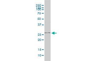 PGAM1 monoclonal antibody (M01), clone 2G1-A6 Western Blot analysis of PGAM1 expression in Jurkat .