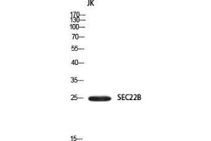 Western Blot (WB) analysis of JK using SEC22B antibody. (SEC22B anticorps)