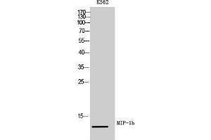 Western Blotting (WB) image for anti-Chemokine (C-C Motif) Ligand 4 (CCL4) (Internal Region) antibody (ABIN3181489)