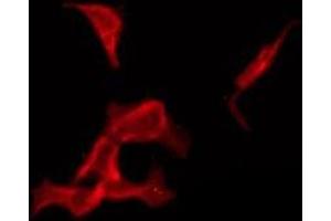 ABIN6276121 staining COLO205 by IF/ICC.