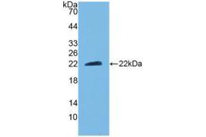 Western blot analysis of recombinant Mouse CNTF.