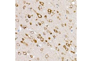 Immunohistochemistry of paraffin-embedded rat brain using GLUT3/SLC2 Rabbit pAb (ABIN6134111, ABIN6147961, ABIN6147962 and ABIN6224173) at dilution of 1:50 (40x lens). (SLC2A3 anticorps  (AA 150-250))