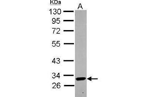 WB Image Sample (30 ug of whole cell lysate) A: THP-1 10% SDS PAGE antibody diluted at 1:1000 (KIR2DL4/CD158d anticorps  (Center))