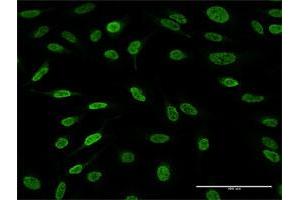 Immunofluorescence of purified MaxPab antibody to AFF4 on HeLa cell.