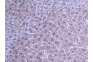 Detection of ABAT in Mouse Liver Tissue using Polyclonal Antibody to 4-Aminobutyrate Aminotransferase (ABAT)