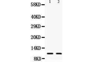 Anti-Eotaxin3 antibody, Western blotting All lanes: Anti Eotaxin3  at 0.