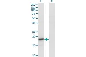 Western Blot analysis of SNCA expression in transfected 293T cell line by SNCA monoclonal antibody (M01), clone 2E4.