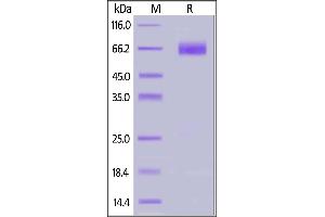 Human Fc epsilon RI alpha, Fc Tag (BLI verified) on  under reducing (R) condition. (Fc epsilon RI/FCER1A Protein (AA 26-204) (Fc Tag))