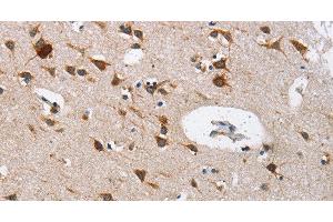 Immunohistochemistry of paraffin-embedded Human brain using Cathepsin L Polyclonal Antibody at dilution of 1:40