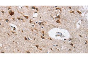 Immunohistochemistry of paraffin-embedded Human brain using Cathepsin L Polyclonal Antibody at dilution of 1:40 (Cathepsin L anticorps)