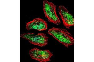 Fluorescent confocal image of Hela cell stained with TSN Antibody (Center) (ABIN656310 and ABIN2845612).