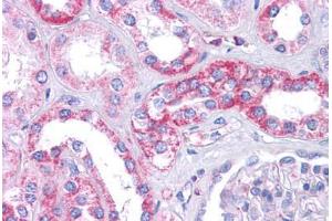 Human Kidney: Formalin-Fixed, Paraffin-Embedded (FFPE) (SIPA1L1 anticorps  (N-Term))