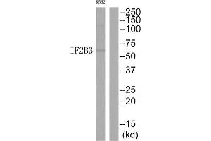 Western Blotting (WB) image for anti-Insulin-Like Growth Factor 2 mRNA Binding Protein 3 (IGF2BP3) (N-Term) antibody (ABIN1848922) (IGF2BP3 anticorps  (N-Term))