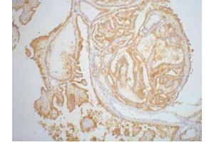 Immunohistochemistry (IHC) staining of Human thyroid tissue paraffin-embedded, diluted at 1:200. (Galectin 3 anticorps)