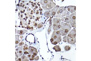 Immunohistochemistry of paraffin-embedded mouse pancreas using SEC14L2 Rabbit pAb (ABIN6132639, ABIN6147484, ABIN6147485 and ABIN6214889) at dilution of 1:200 (40x lens).
